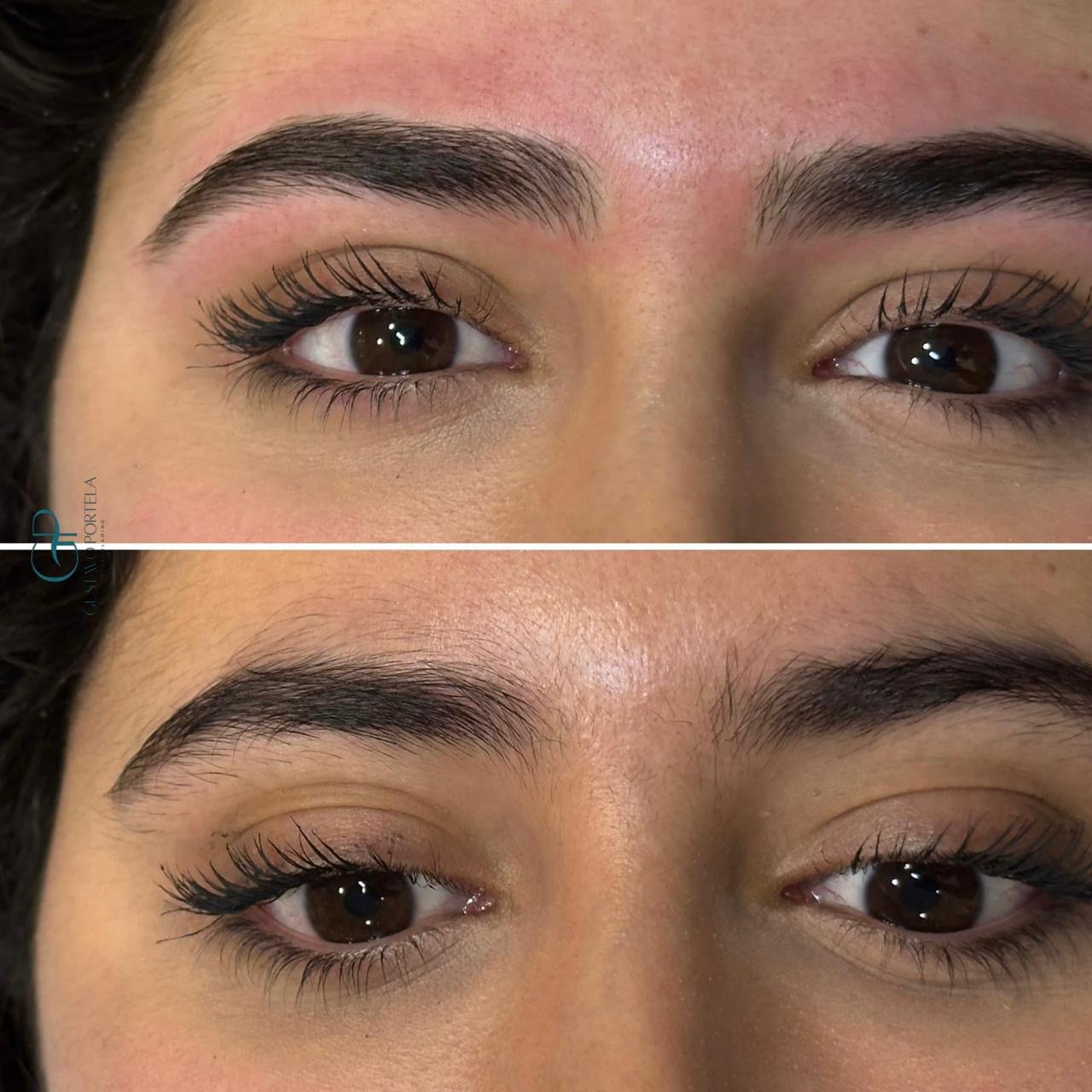 Resultado de microblading fio a fio, antes e depois